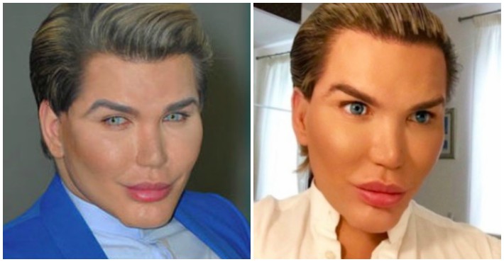 The Human Ken Doll Has Finally Released Photos Of Himself Before His 58 Cosmetic Surgeries Viraly