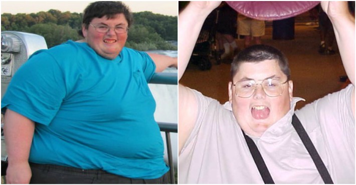 One-Legged Man Loses A Whopping 500lbs After Doctors Gave Him Three ...